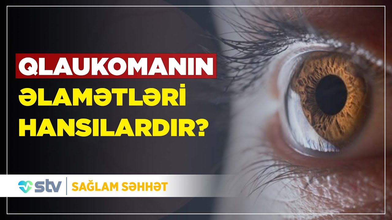 Qlaukoma xəstəliyinin yaranma səbəbləri nələrdir?