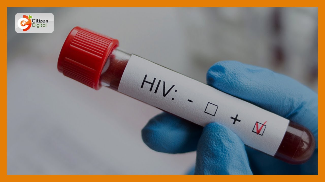 HIV YATESA VIJANA: Vijana 88 huambukizwa virusi vya HIV kila siku nchini