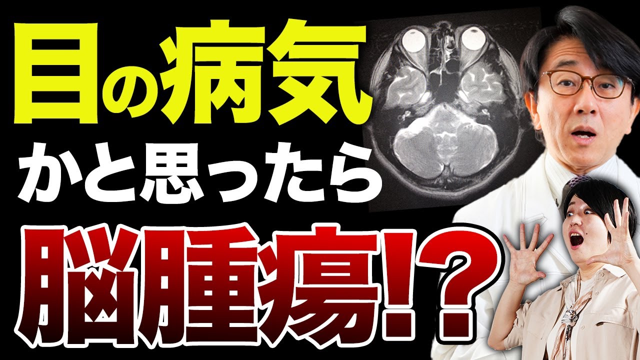目の病気と間違えやすい怖い病気！？【眼科医解説】