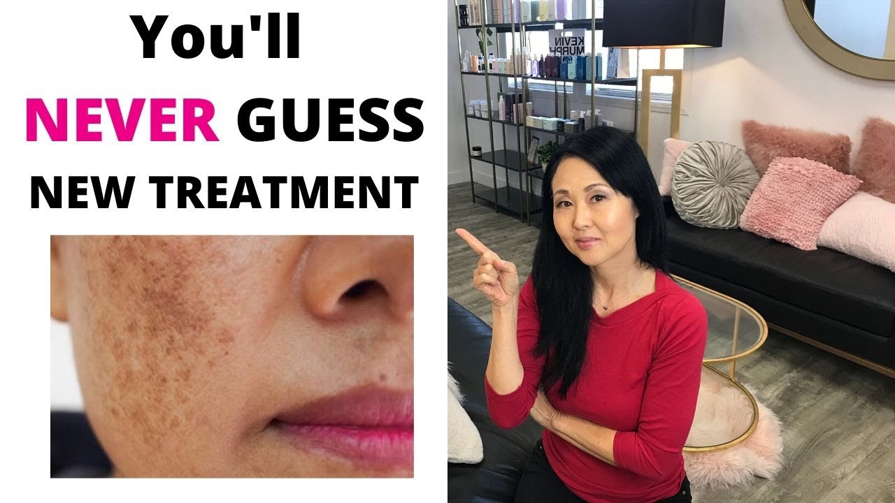 Stubborn Hyper Pigmentation and Sensitive to sunscreen Treatments #goseechristysunscreen
