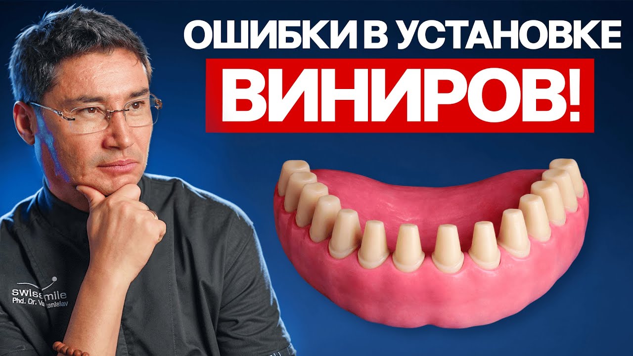 Не делай ТАКИЕ виниры в 2026 году! Как понять, что ставить?
