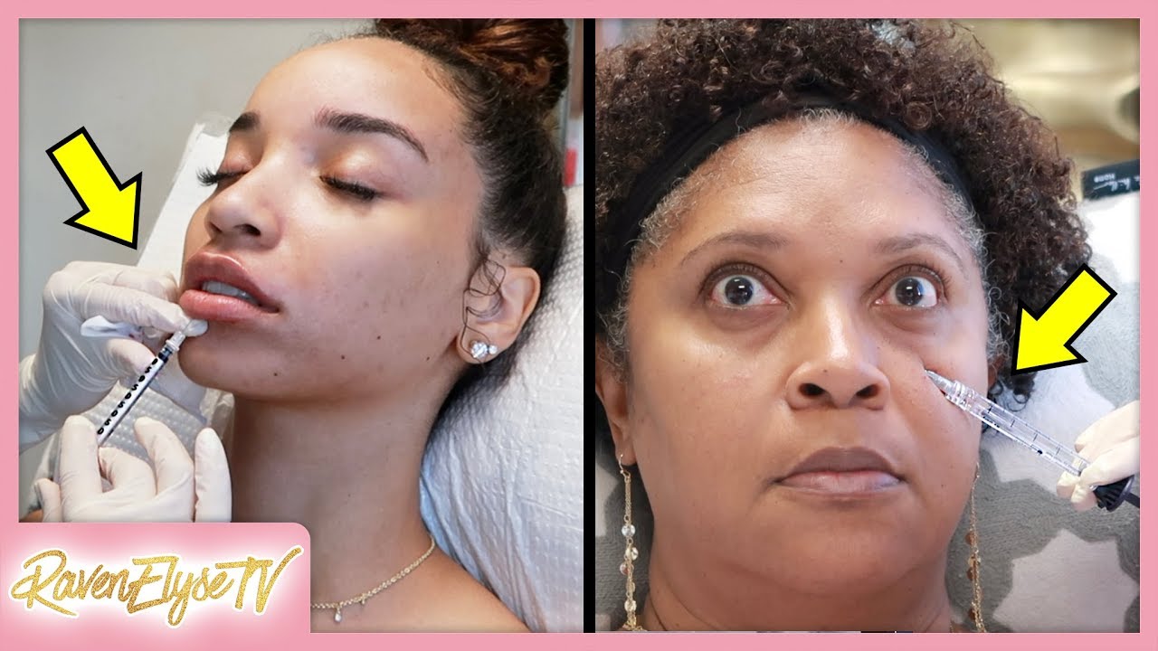 LIP INJECTIONS & UNDER EYE FILLER | Mom & Daughter!