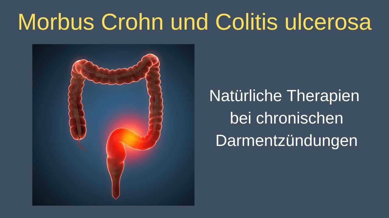 Morbus Crohn und Colitis ulcerosa - Alexander Glogg im Gespräch mit Dr. Volker Schmiedel