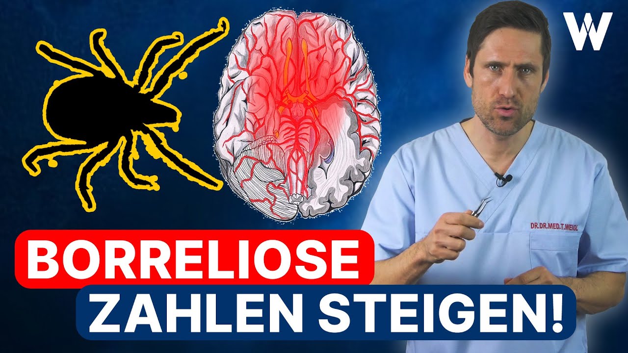 Zeckenalarm: Borreliose-Symptome erkennen! Die Gefahr der Neuroborreliose | Borreliose-Behandlung