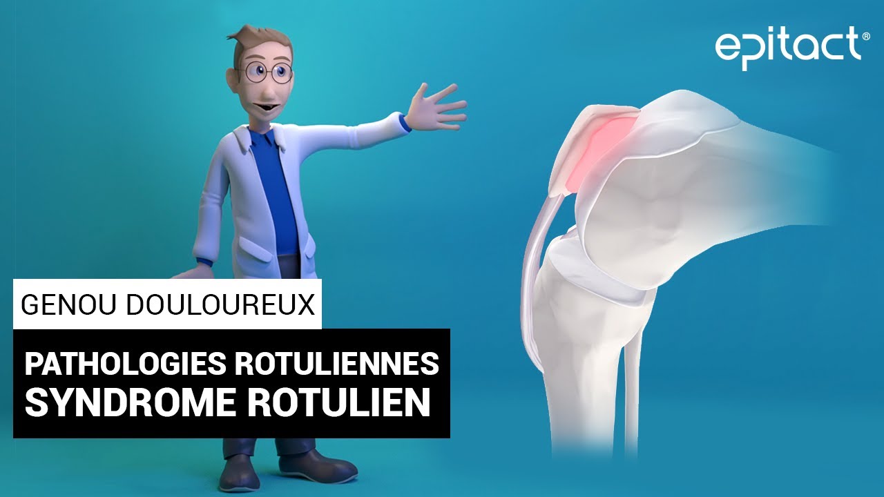 Syndrome Rotulien | Explication - EPITACT