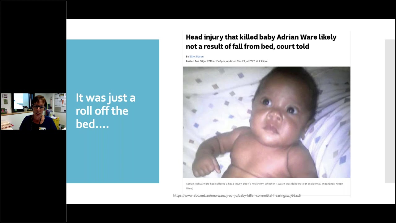 New National Paediatric Head Injury Guidelines: What GPs Need to Know