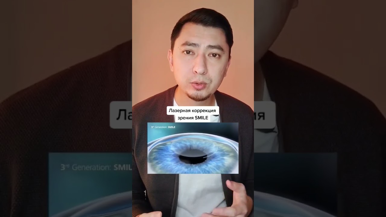 Лазерная коррекция зрения SMILE