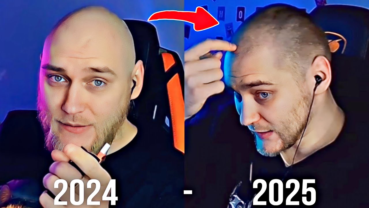 EASTERCAKE ВОССТАНОВИЛ ВОЛОСЫ БЕЗ ПЕРЕСАДКИ ЗА 4 МЕСЯЦА?!