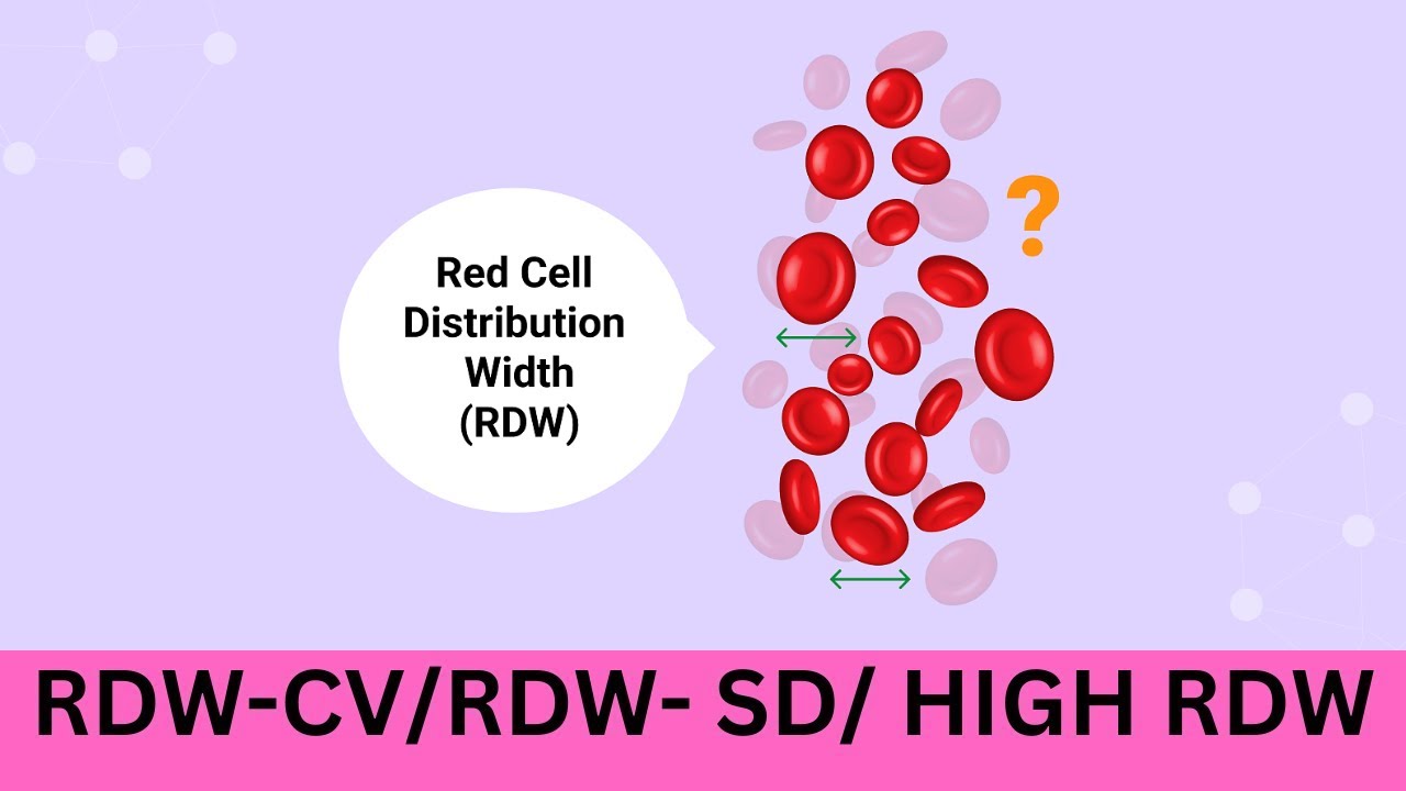 RDW (Red cell Distribution Width ) RDW-SD Vs RDW -CV