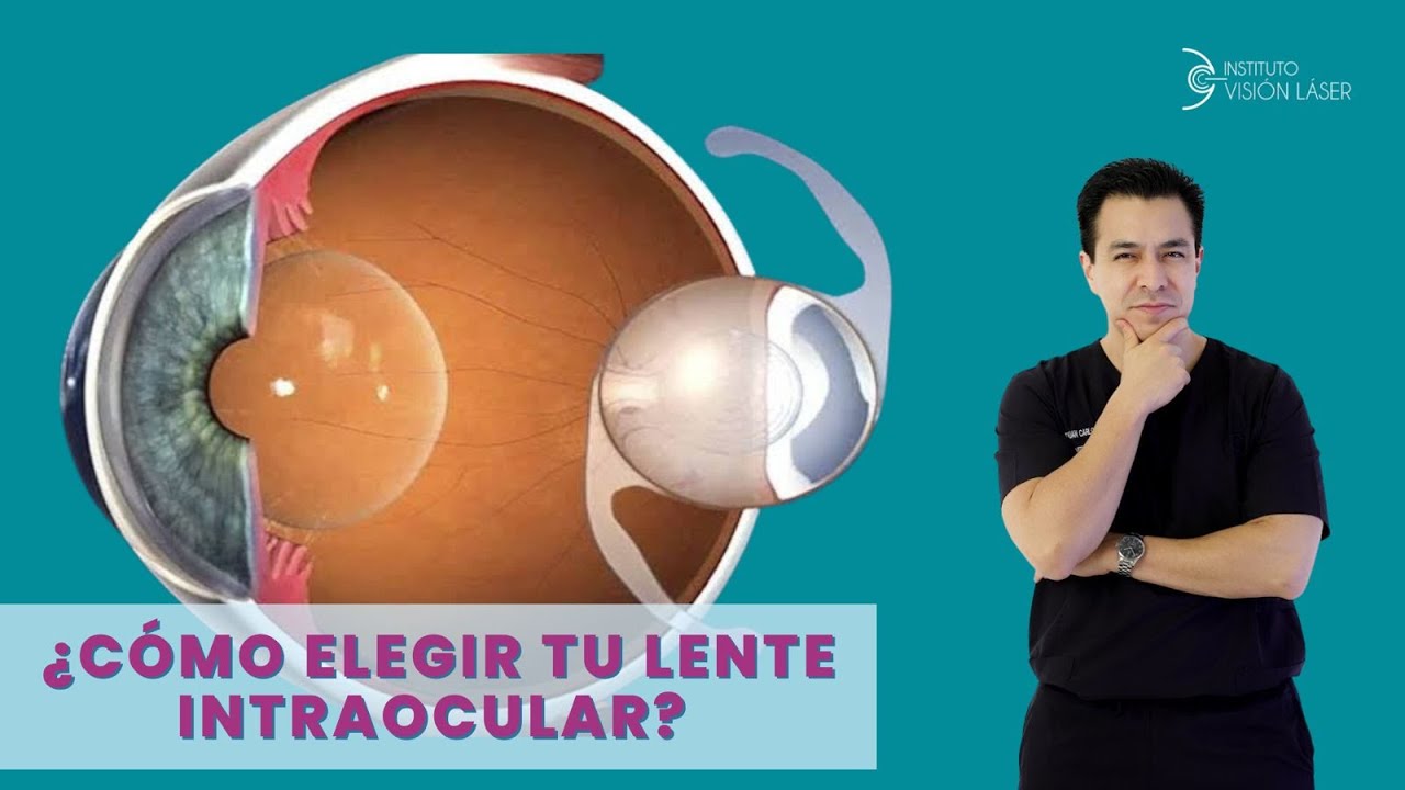 ¿CÓMO ELEGIR TU LENTE INTRAOCULAR?