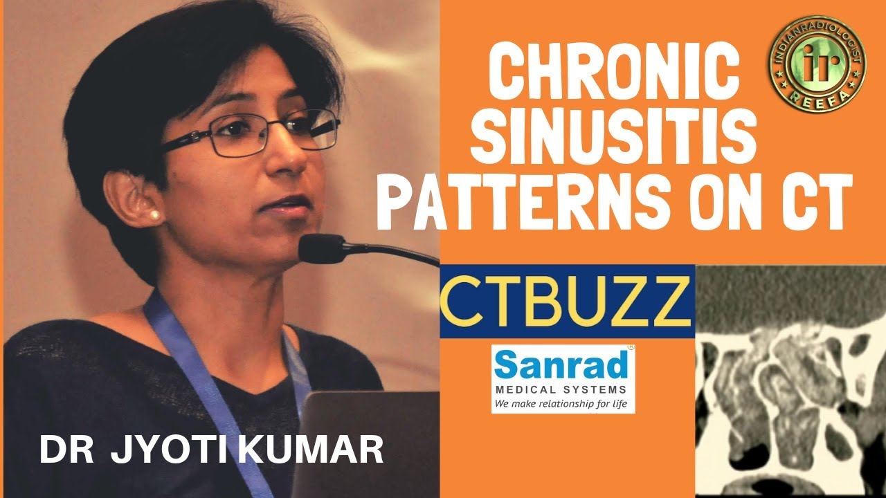 TMT: Chronic Sinusitis - Patterns on CT by Dr Jyoti Kumar