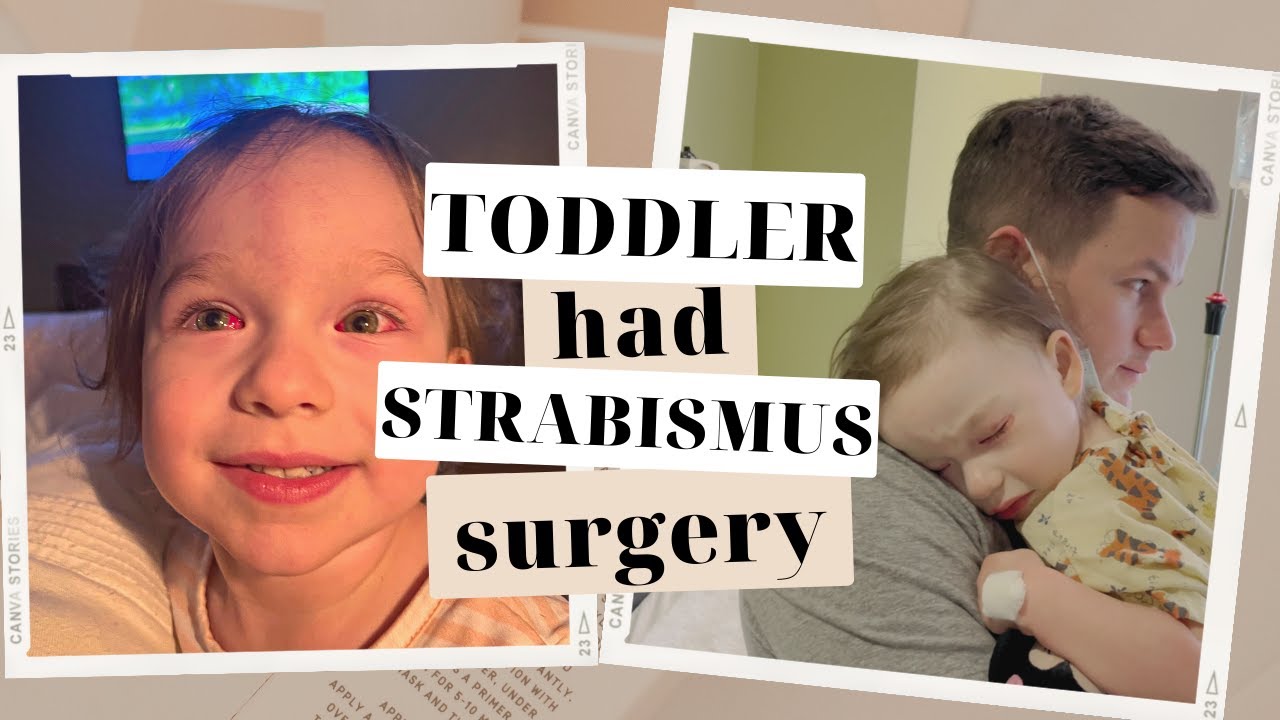 Stella's Surgery | Strabismus in Toddler