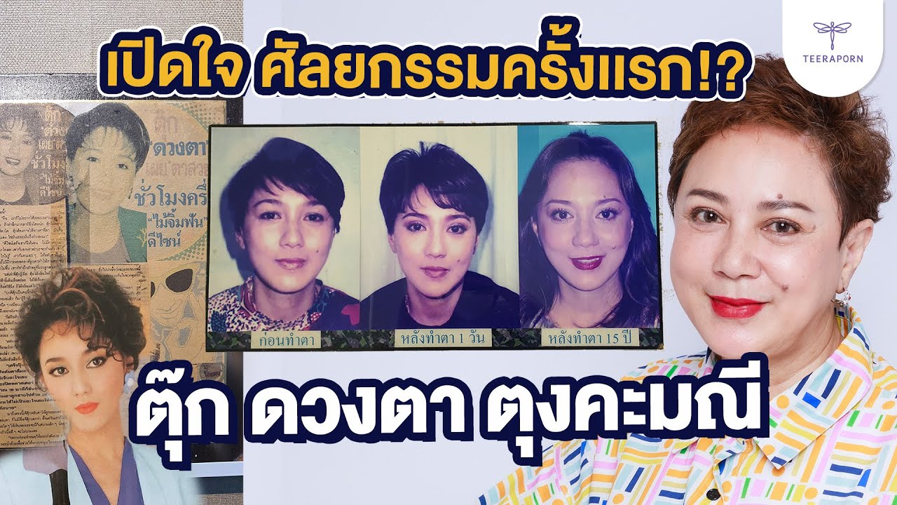 เปิดใจ ตุ๊ก ดวงตา ศัลยกรรมครั้งเเรกเมื่อ 30 ปีที่เเล้ว กลับมาอีกรอบศัลย์เพิ่ม!? #ทำตาที่ไหนดี