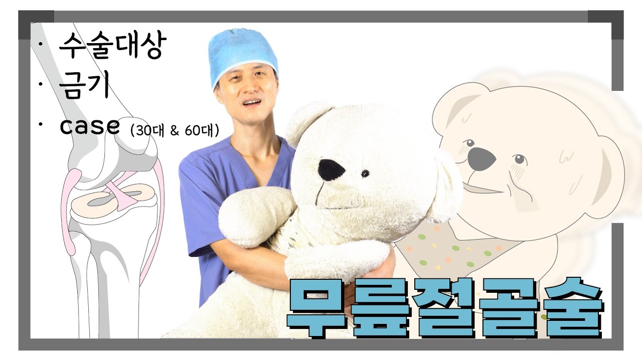 무릎절골술 시리즈 19 - 수술대상, 금기, 젊은 환자·퇴행성 환자case