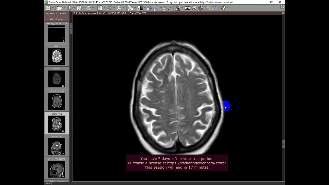 case discussion 1