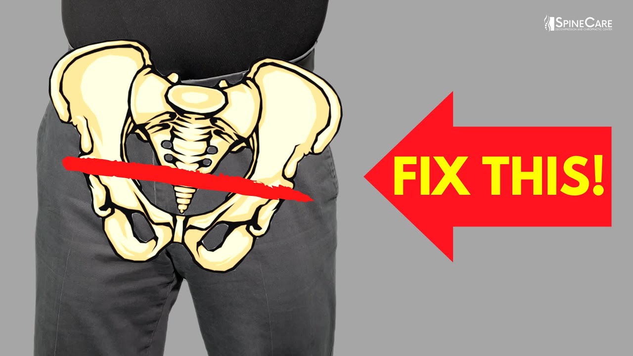 How to Get Rid of a High Hip for Good