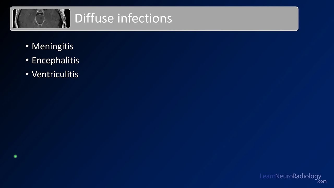 Intracranial infections - 2 - Diffuse Infections