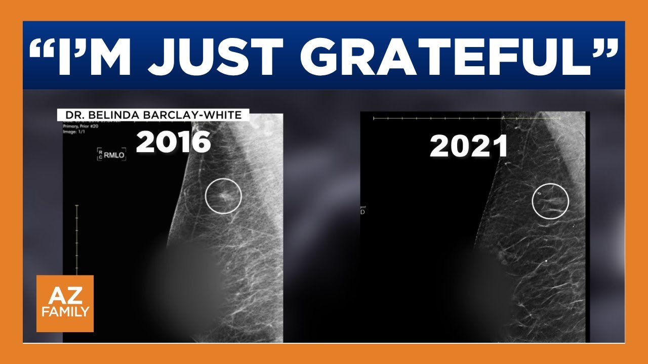 New life-changing treatment available for breast cancer