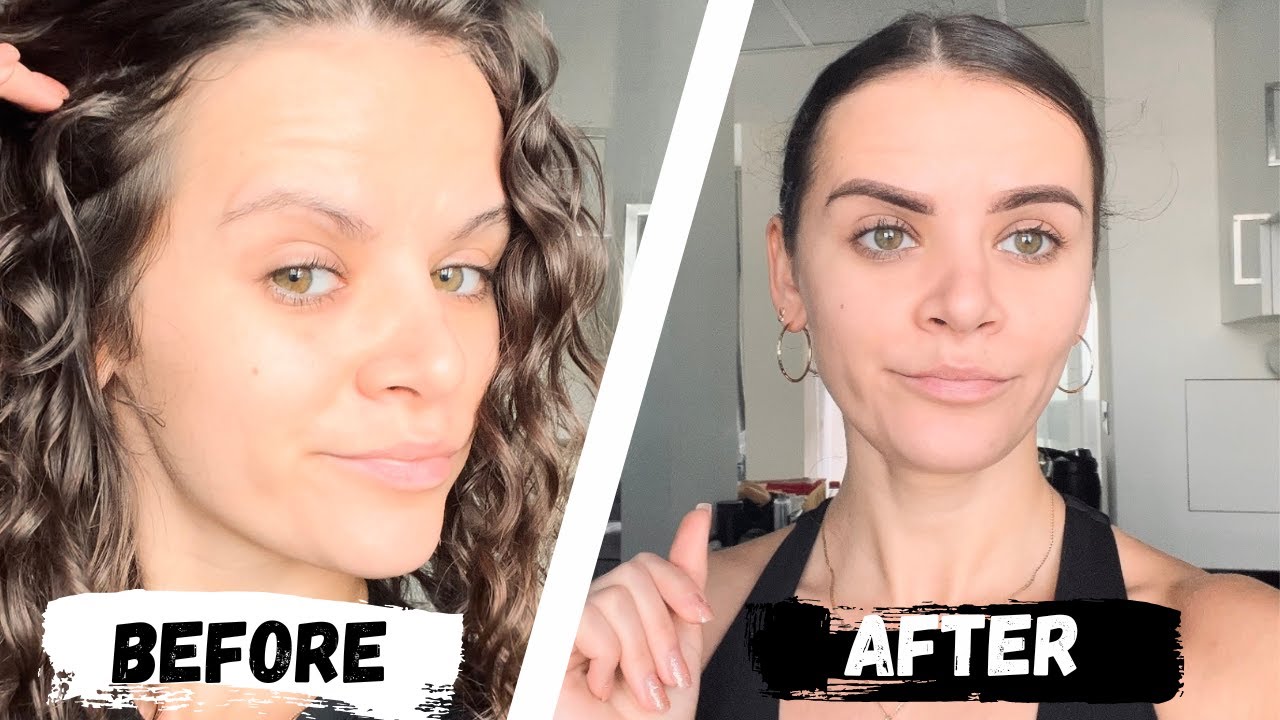 MICROSHADING | 14 DAYS HEALING UPDATE | REVIEW