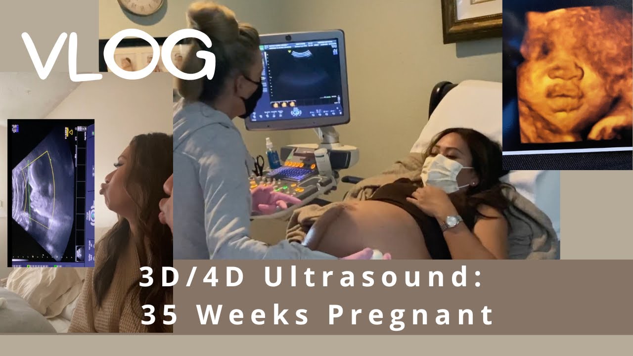 Adorable Baby 3D/4D Ultrasound at 35 weeks Pregnant| First Time Parents | House of CasLla