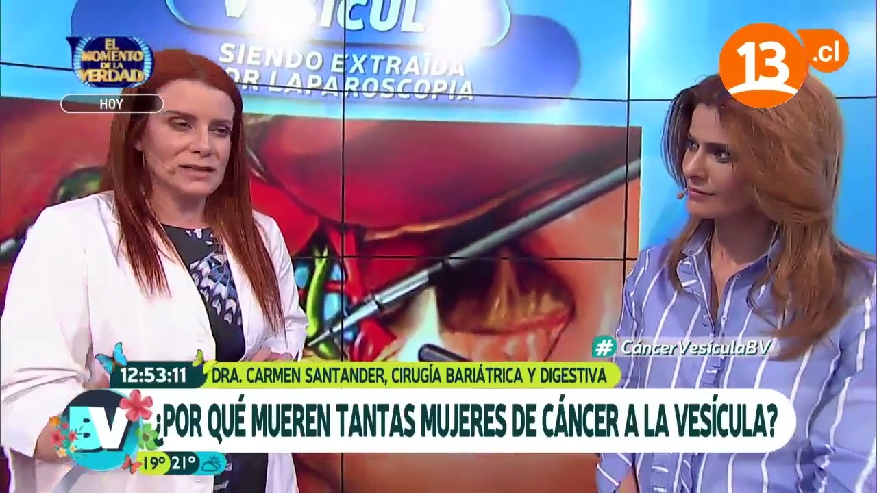 Conoce el cáncer de vesícula (Parte 2) | Bienvenidos