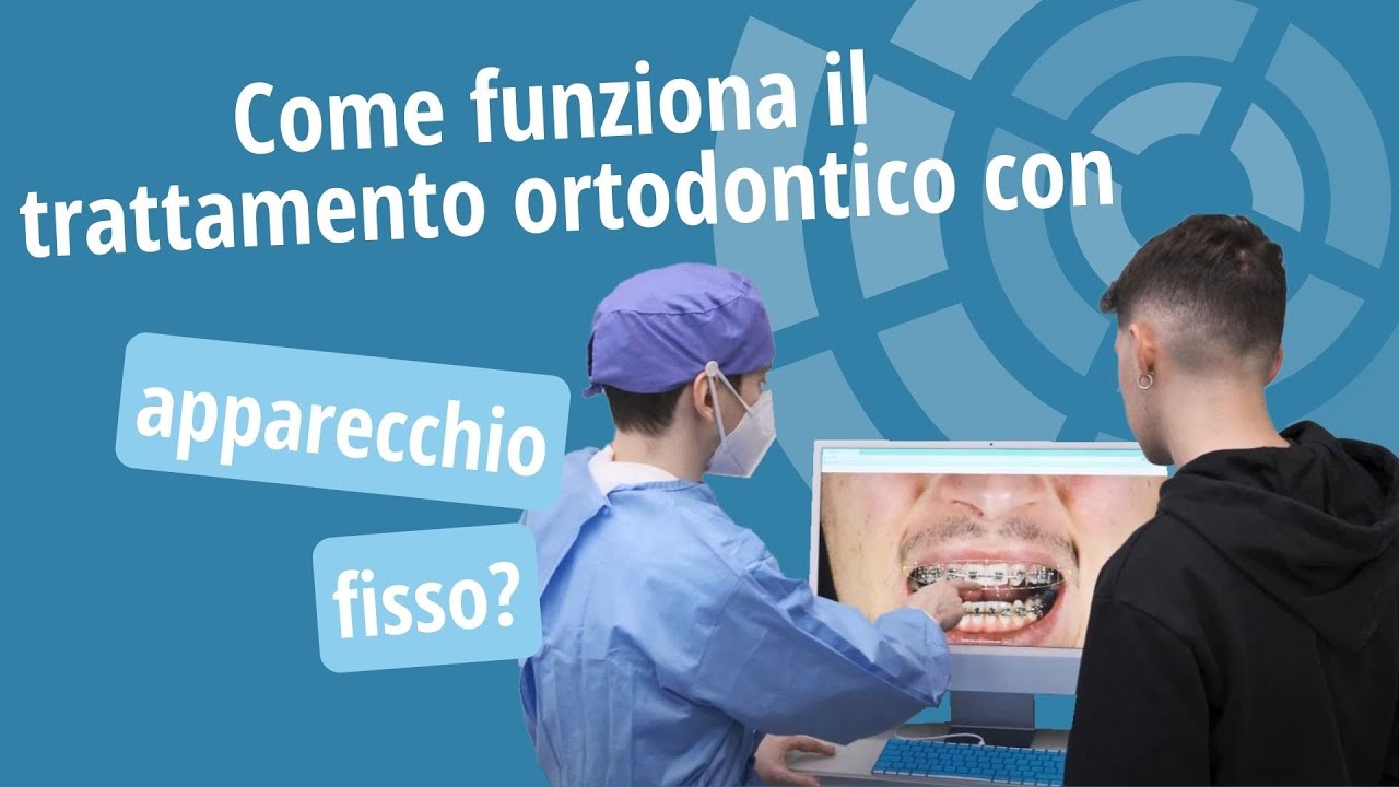 Trattamento ortodontico con apparecchio fisso: come funziona - Studio Ortodontico Cocconi Rapa