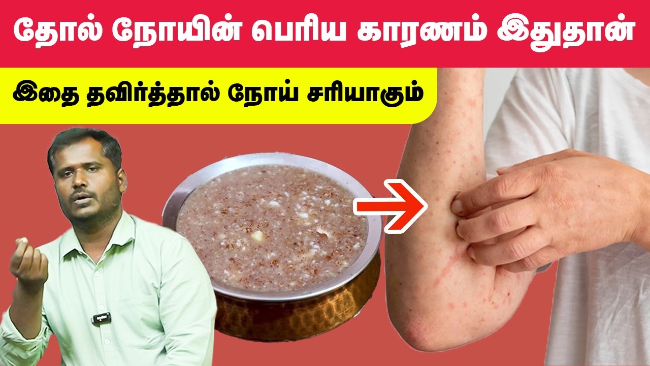 எந்த தோல் நோயும் இந்த உணவில் சரியாகாமல் இருக்காது | இதை மட்டும் சாப்பிடக்கூடாது | Yogam Wellness