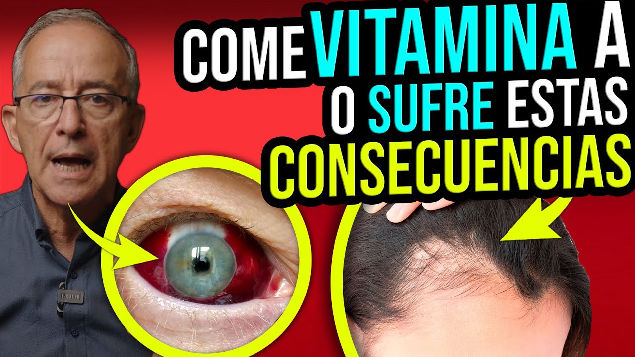 QUE SENTIMOS CUANDOS NOS FALTA VITAMINA A ? - Oswaldo Restrepo RSC