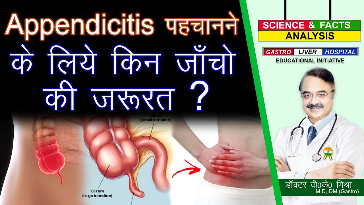 APPENDICITIS पहचानने के लिये किन जाँचो की जरुरत ? || WHAT TESTS DIAGNOSE APPENDICITIS