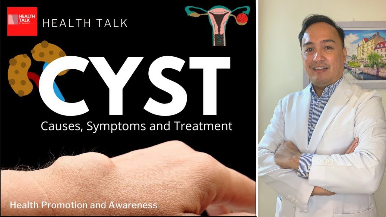 What to know about cysts?