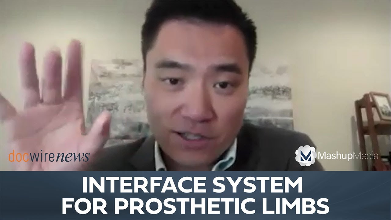 Dr. Ted Kung on a Neuromuscular Interface System for Patients With Upper Limb Loss