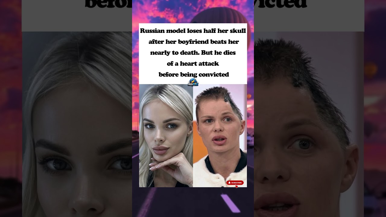Model Survives Brutal Attack  Attacker Dies of Heart Attack Before Trial 😱🏥 #shorts