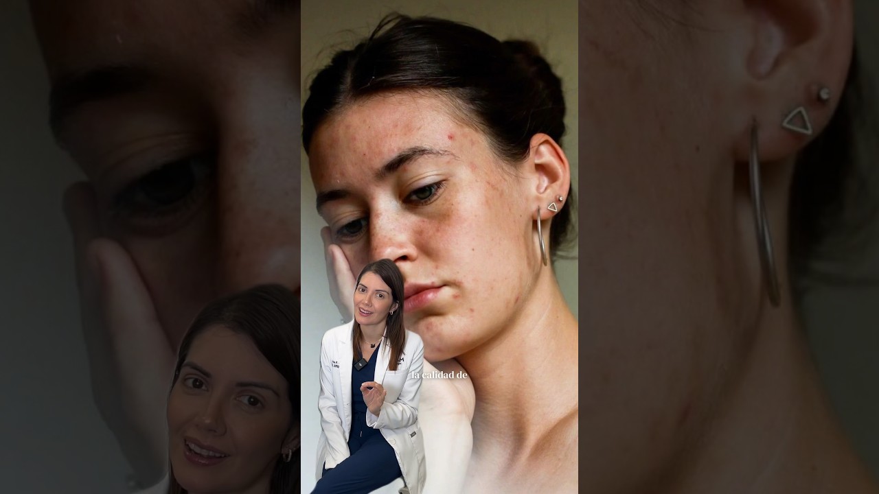 Disminuye tus manchas con IPL luz pulsada intensa ⚡️ #manchasenlapiel #cuidadodelapiel #laser #spa