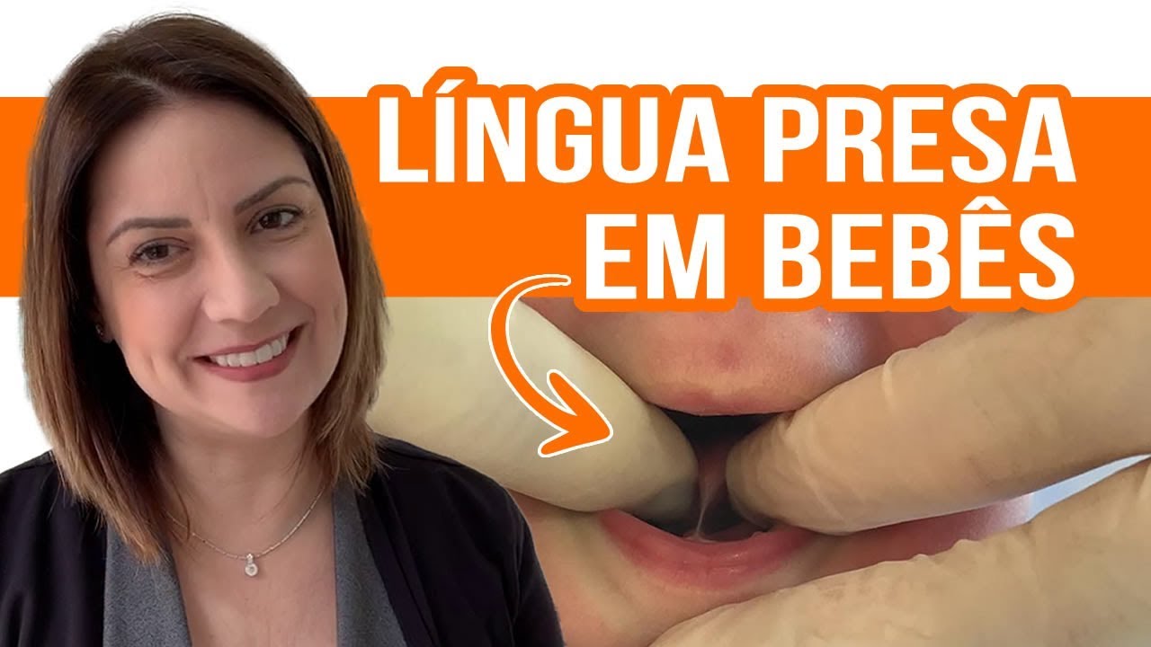 Língua Presa em Bebês e como ela Interfere na Amamentação - ANDRESSA BORTOLASSO