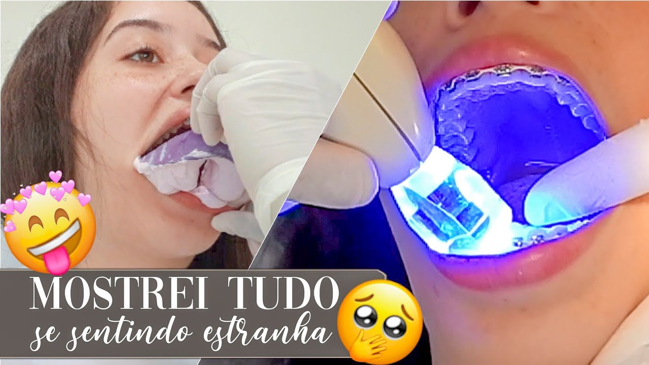 TIREI MEU APARELHO