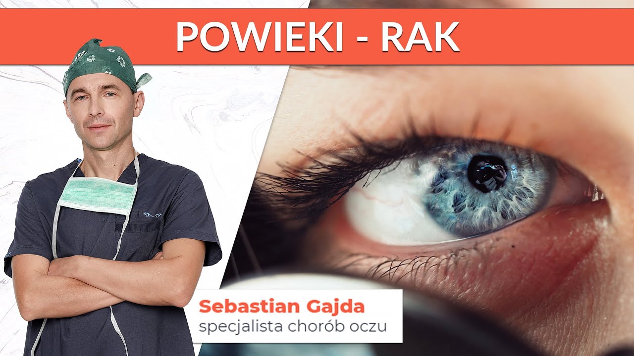Czym jest rak podstawnokomórkowy skóry powiek?