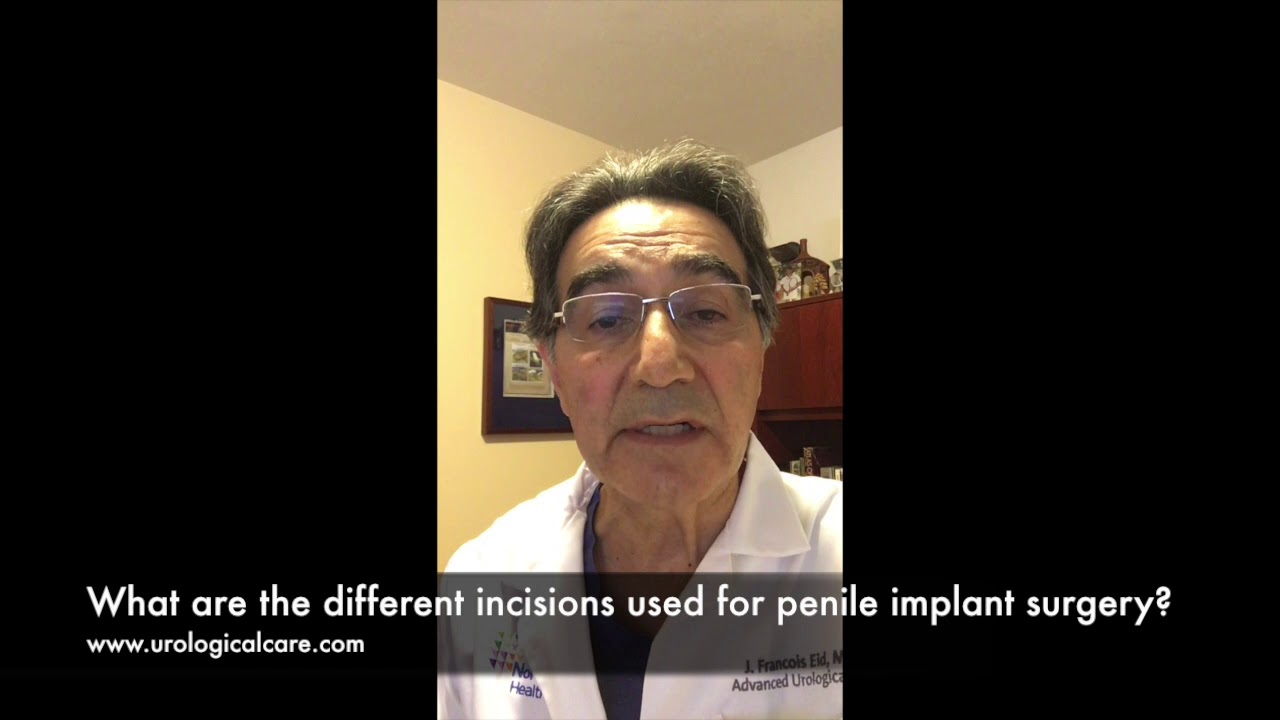 What are the different incisions used for Penile Implant surgery?