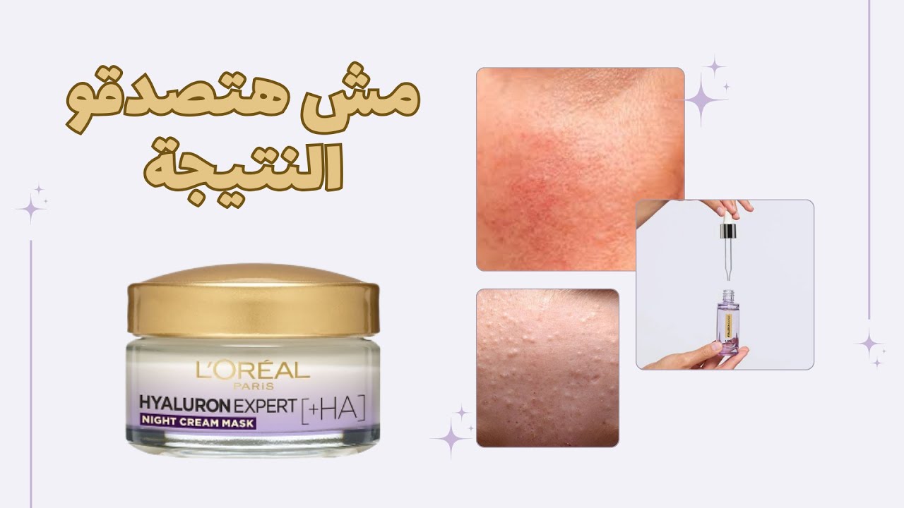 الفيديو ده هيختصرلك التجربة L’Oréal Paris Hyaluron Expert - لوريال باريس هيالورون اكسبرت