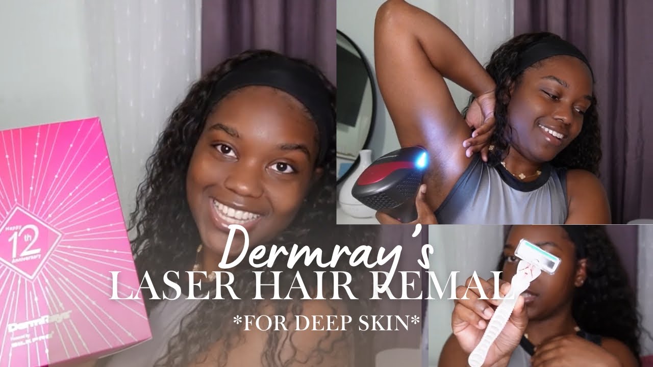 AT HOME LASER HAIR REMOVAL FOR MELANATED SKIN ft. Dermrays | I TRIED AT HOME LASER FOR THE 1st TIME 