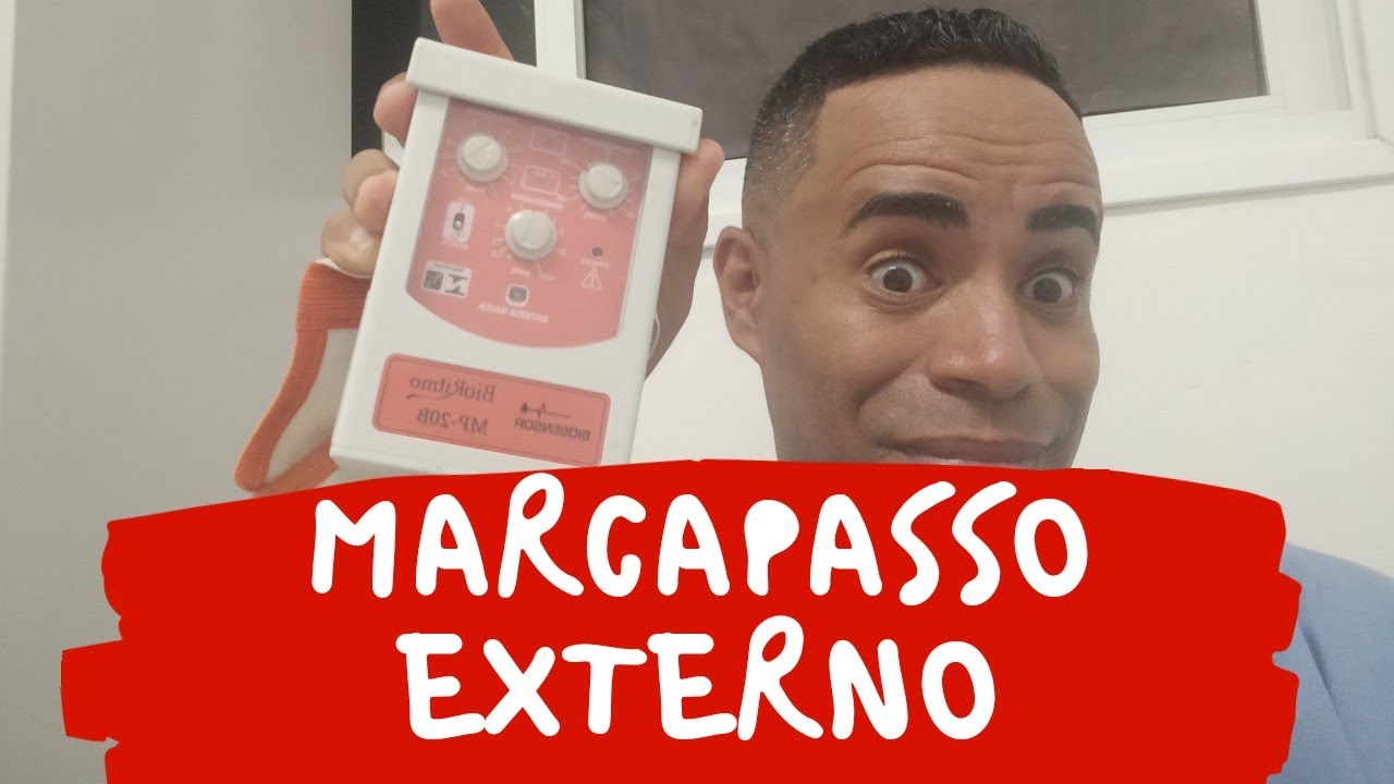 Marcapasso Externo - como funciona o marcapasso Externo