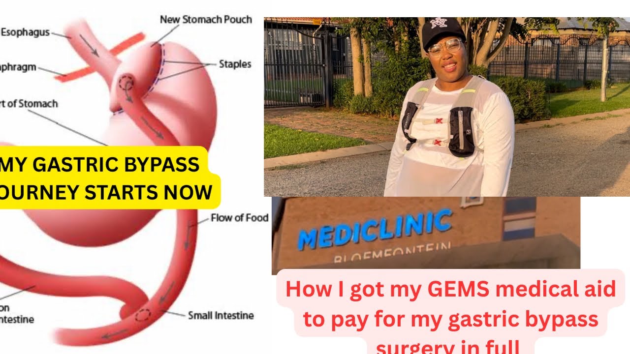 GEMS medical aid approved my gastric bypass surgery| got it done at Mediclinic Bloem