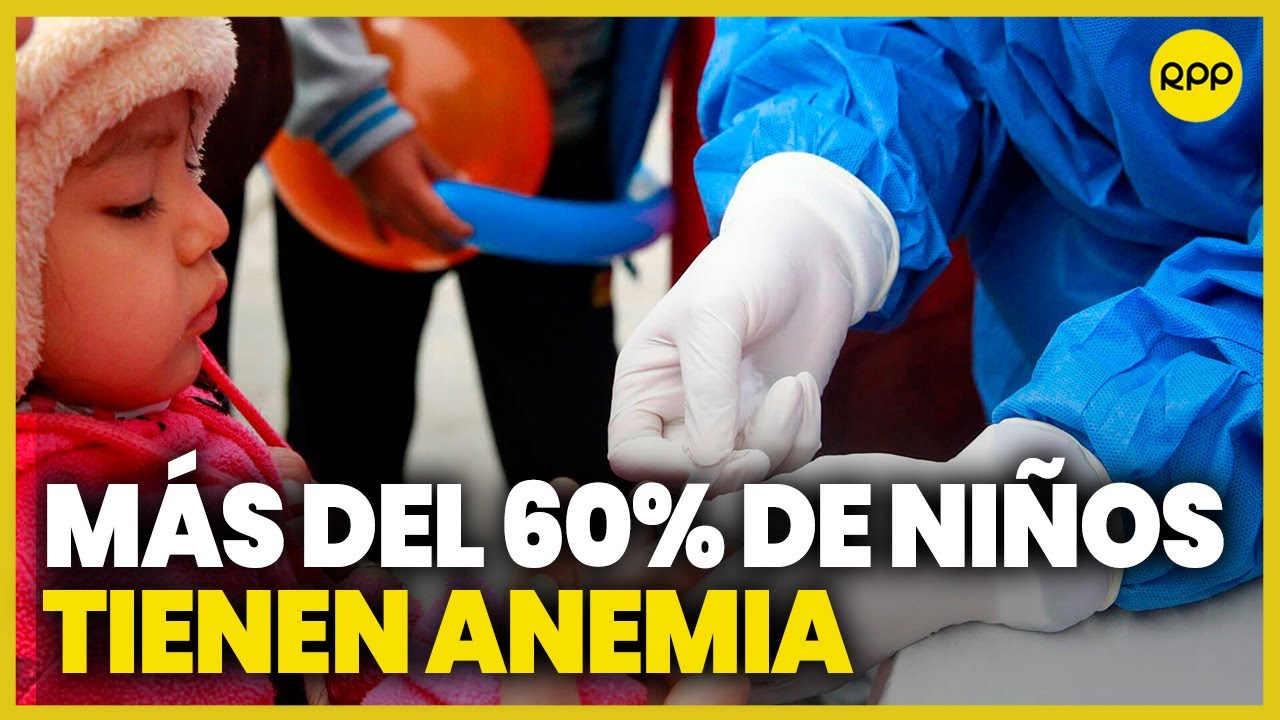 Anemia en el Perú: Más del 60% de niños tienen esta enfermedad