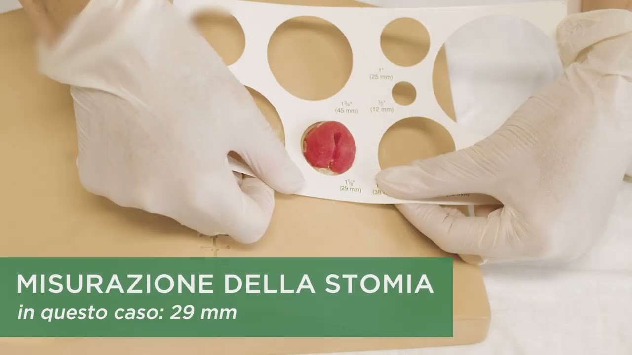 Guida allo stomacare - Colo/Ileostomia, sistema bipezzo placca ritagliabile