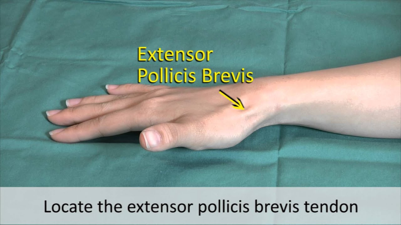 Musculoskeletal Examination and Joint Injection Series_ DeQuervain's Tenosynovitis Injection