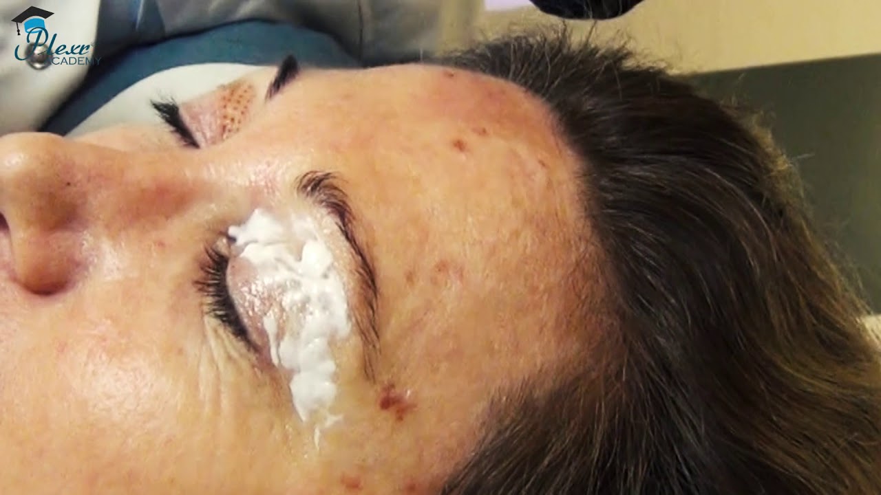 PLEXR Plus Traitement blépharoplastie