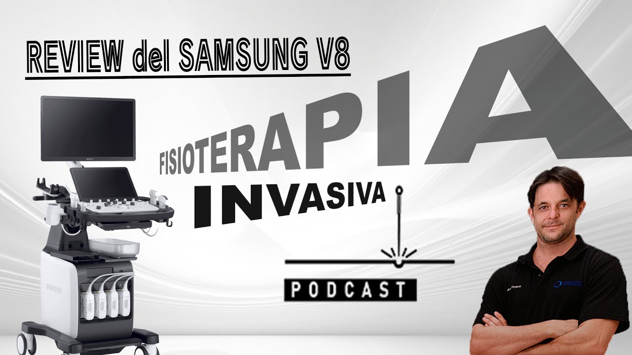 REVIEW SAMSUNG V8 ULTRASOUND