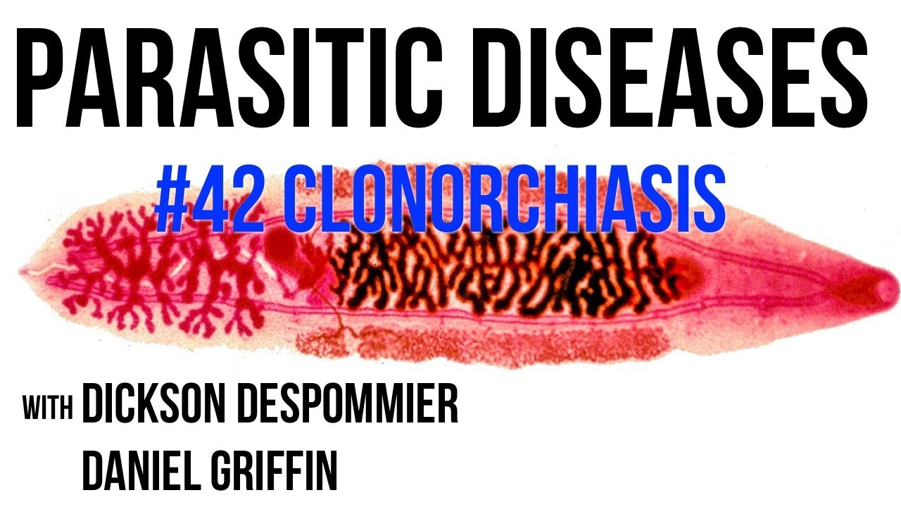 Parasitic Diseases Lectures #42: Clonorchiasis