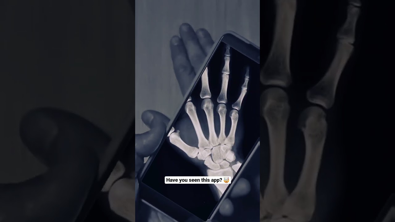 Does This App Let You Take X-Rays at Home? #shorts