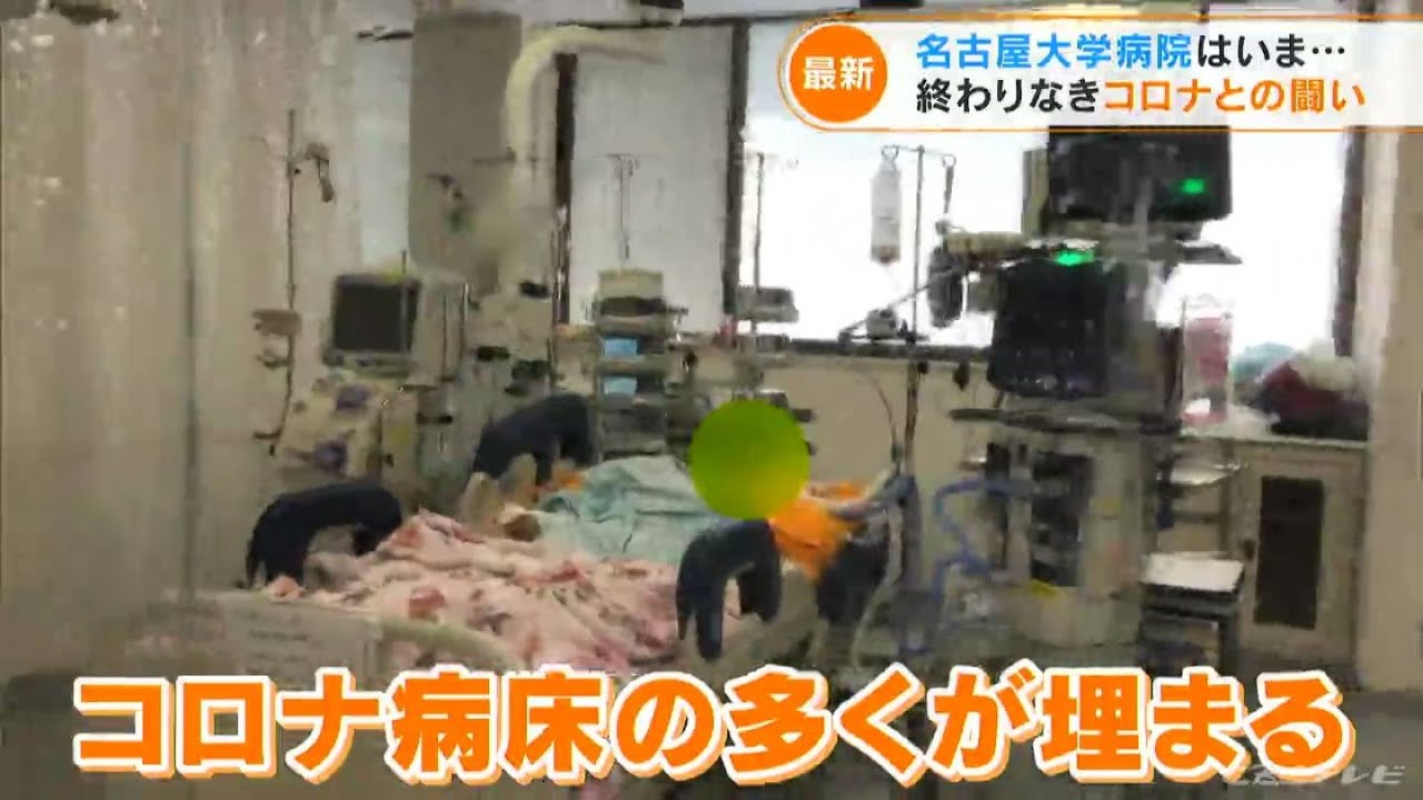「心筋炎」「心筋梗塞」…第７波で“人工肺”ECMO（エクモ）の出番増える 名古屋大学病院“コロナ病床”ひっ迫(2022/8/19)