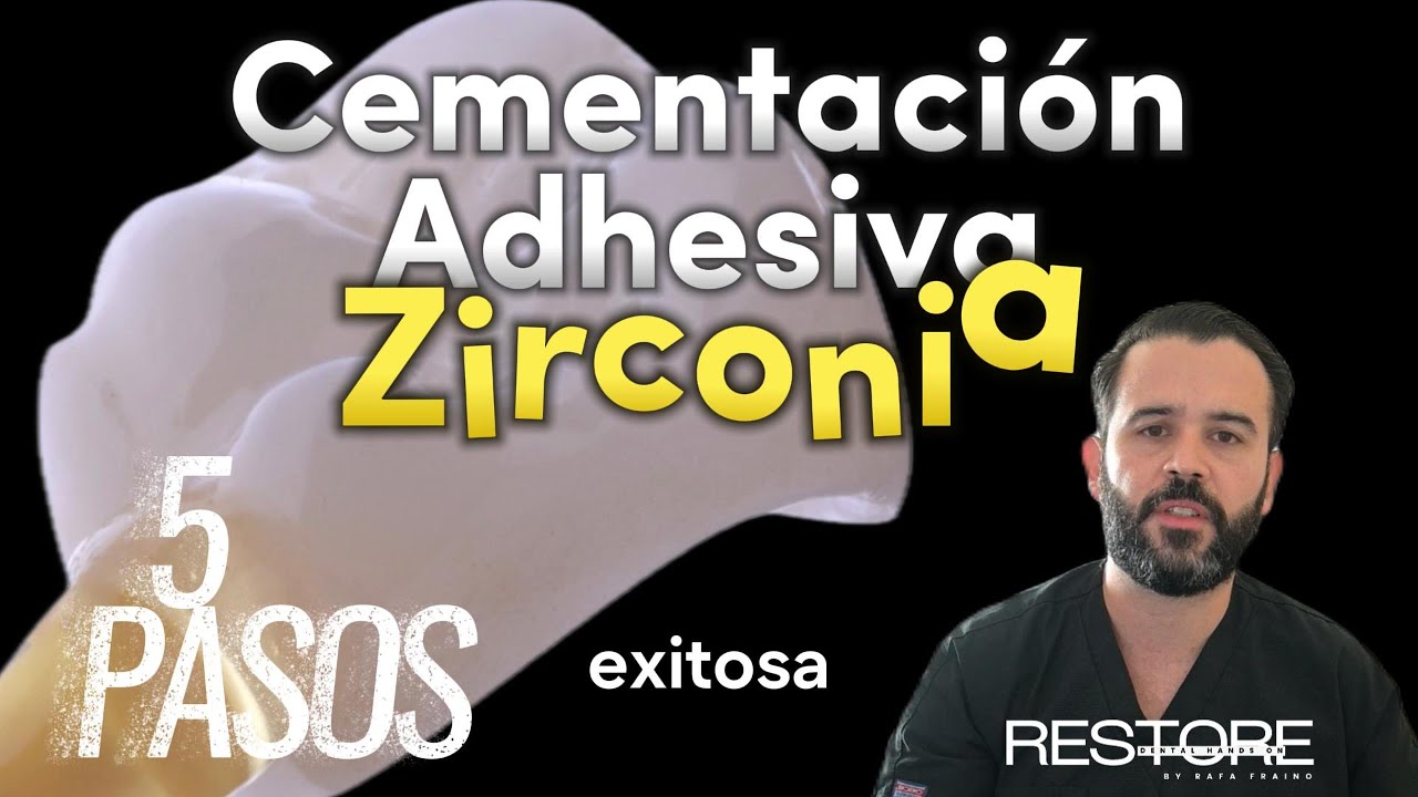 Zirconia: Cementación Adhesiva en 5 Pasos | Guía Completa #dentist #zirconiacrown #zirconia